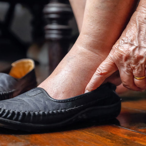 Jaké parametry by měla splňovat obuv pro diabetiky?
